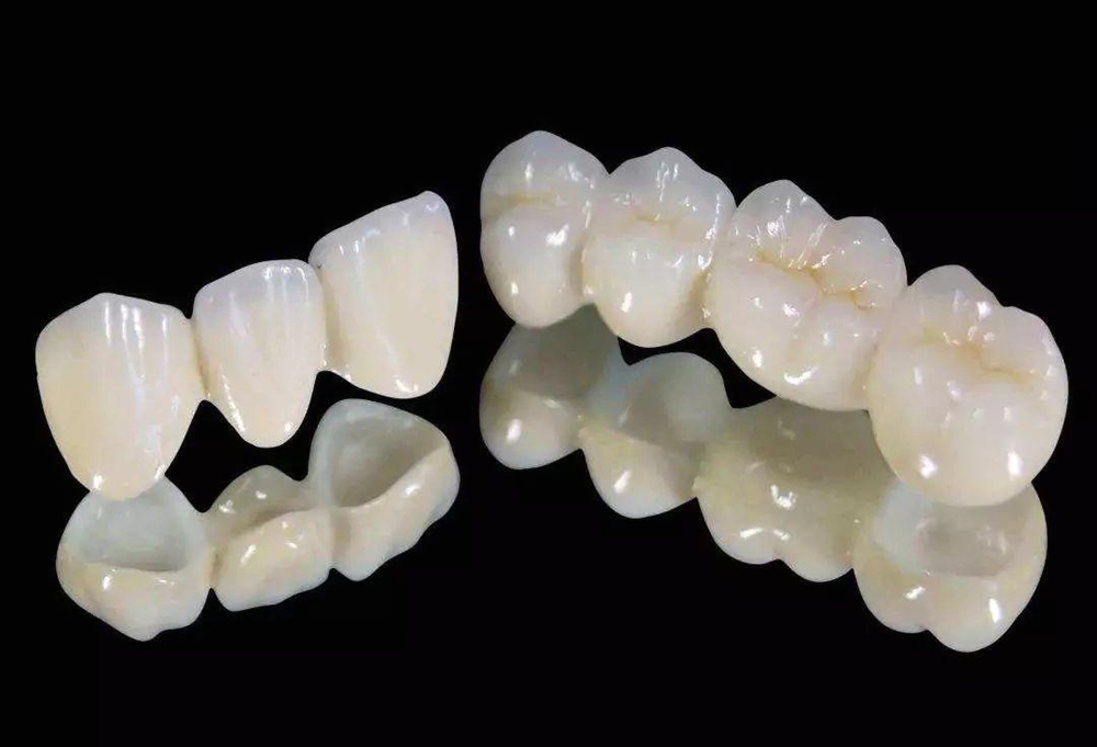 Lava氧化锆全瓷牙